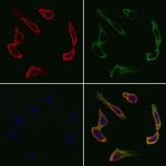VEGFB Polyclonal Antibody