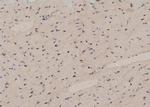 Phospho-TBC1D1 (Ser237) Antibody in Immunohistochemistry (Paraffin) (IHC (P))