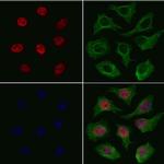 SF3B1 Polyclonal Antibody