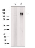 SF3B1 Antibody in Western Blot (WB)