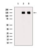 SF3B1 Antibody in Western Blot (WB)