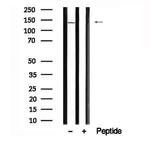 SF3B1 Antibody in Western Blot (WB)