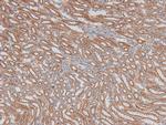 Phospho-ILK (Ser343) Polyclonal Antibody