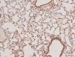 Phospho-STK38/STK38L (Thr444, Thr442) Antibody in Immunohistochemistry (Paraffin) (IHC (P))