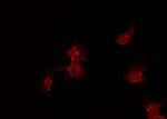 Phospho-PKC alpha (Ser657) Antibody in Immunocytochemistry (ICC/IF)
