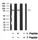 Phospho-PKC alpha (Ser657) Antibody in Western Blot (WB)