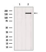 Phospho-TOPBP1 (Ser1159) Antibody in Western Blot (WB)