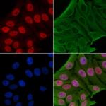 Phospho-TOPBP1 (Ser1159) Polyclonal Antibody