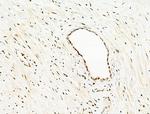 Phospho-TOPBP1 (Ser1159) Antibody in Immunohistochemistry (Paraffin) (IHC (P))