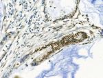 Phospho-TOPBP1 (Ser1159) Antibody in Immunohistochemistry (Paraffin) (IHC (P))