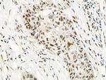 Phospho-TOPBP1 (Ser1159) Antibody in Immunohistochemistry (Paraffin) (IHC (P))