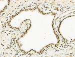 Phospho-TOPBP1 (Ser1159) Antibody in Immunohistochemistry (Paraffin) (IHC (P))