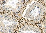 Ubiquilin 4 Polyclonal Antibody