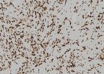 Acrosin Polyclonal Antibody