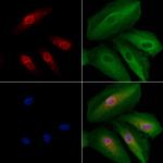 v-Myb Polyclonal Antibody