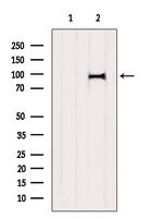 A20A3 Antibody in Western Blot (WB)