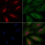 A20A3 Polyclonal Antibody