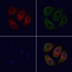 ARMX1 Polyclonal Antibody