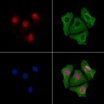 NR2F2 Antibody in Immunocytochemistry (ICC/IF)