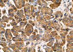 ARRDC1 Polyclonal Antibody