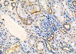 ARRDC1 Antibody in Immunohistochemistry (Paraffin) (IHC (P))