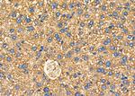ARRDC1 Antibody in Immunohistochemistry (Paraffin) (IHC (P))