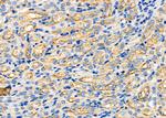 ARRDC1 Antibody in Immunohistochemistry (Paraffin) (IHC (P))