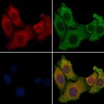 ARRDC2 Polyclonal Antibody