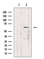ARSK Polyclonal Antibody
