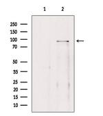 BRD3 Polyclonal Antibody