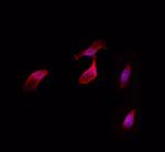 C/EBP delta/epsilon Polyclonal Antibody