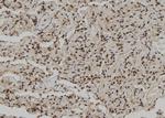 C/EBP zeta Polyclonal Antibody
