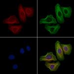 CABLES2 Polyclonal Antibody