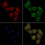 CEP152 Polyclonal Antibody