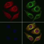 CYB561D1 Polyclonal Antibody