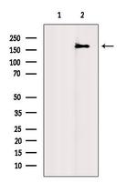 RBM6 Antibody in Western Blot (WB)