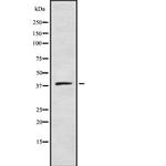 ZDHHC9 Polyclonal Antibody