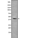 RIMKLB Polyclonal Antibody