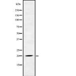 FGF22 Antibody in Western Blot (WB)