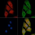 PMP22 Polyclonal Antibody