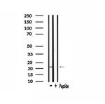 PMP22 Antibody in Western Blot (WB)
