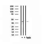 HORMAD1 Polyclonal Antibody