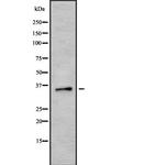 HEY2 Polyclonal Antibody