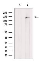 KCNT1 Polyclonal Antibody