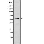 SLC16A12 Polyclonal Antibody
