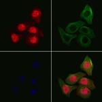 MPHOSPH1 Polyclonal Antibody