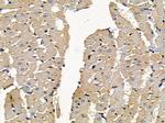 MPHOSPH1 Antibody in Immunohistochemistry (Paraffin) (IHC (P))