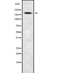 MRCK beta Polyclonal Antibody