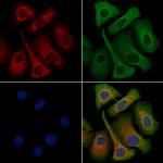 MRGPRF Polyclonal Antibody