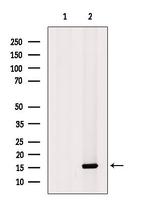 NDUFS5 Polyclonal Antibody